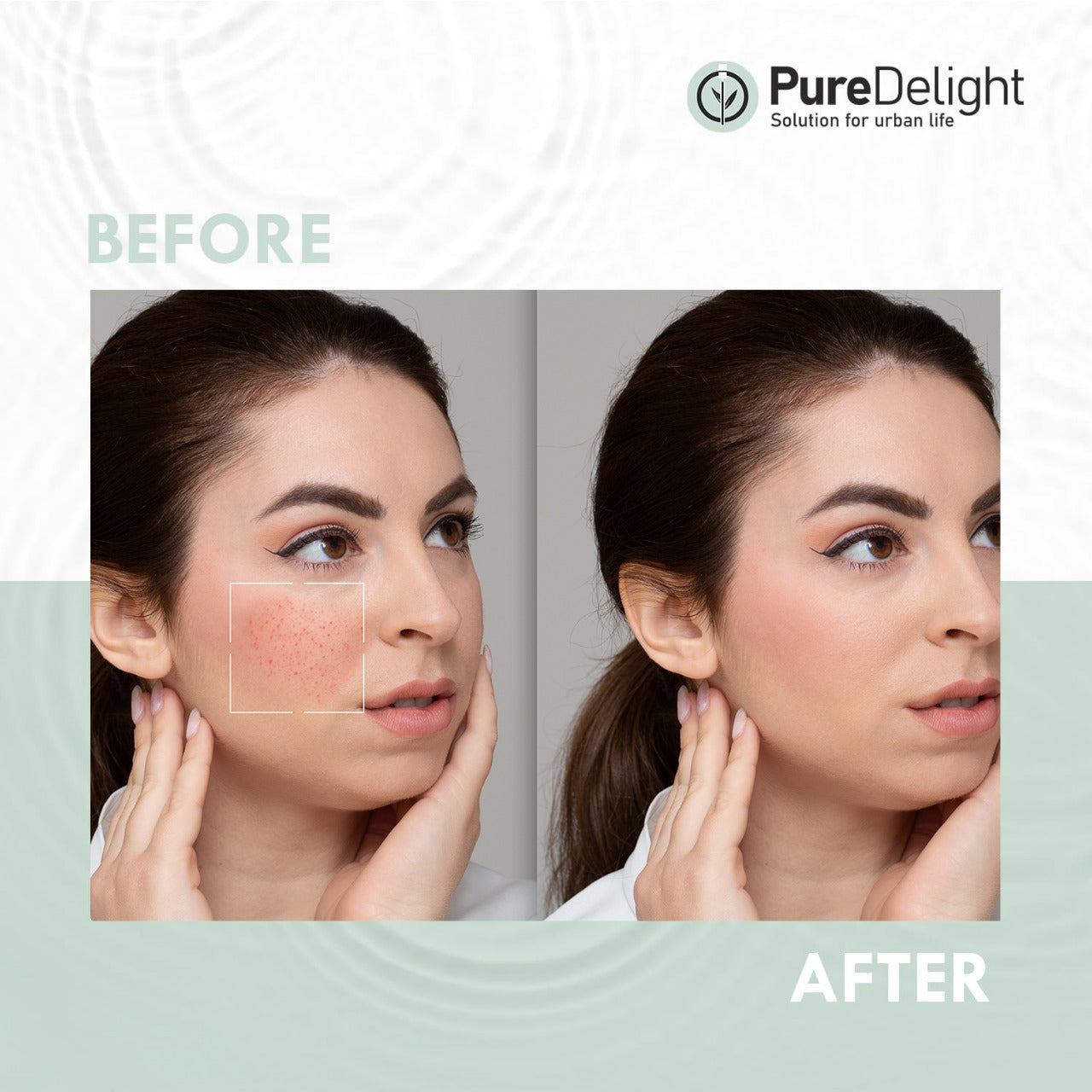 Pure Delight Anti-Acne Foaming Facewash with Vitamin B3 & Tea Tree  (100ml)