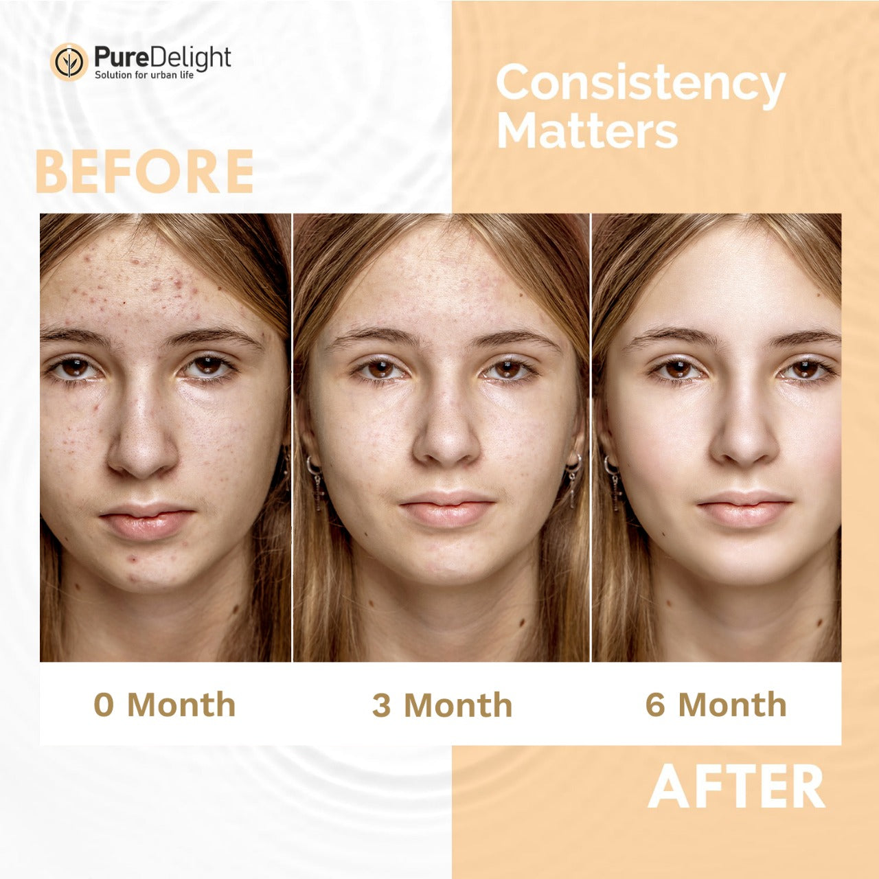 Pure Delight Vitamin C 20% + Niacinamide 10% Serum Combo Brightening & Acne Mark Solution
